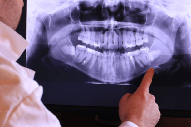 Best Emergency Broken Tooth Repair in Fetters Hot Springs Agua Liente, CA